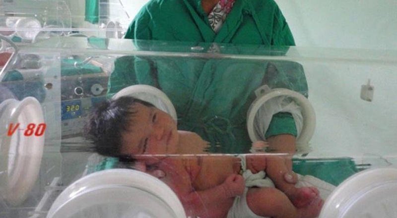 mortalidad infantil