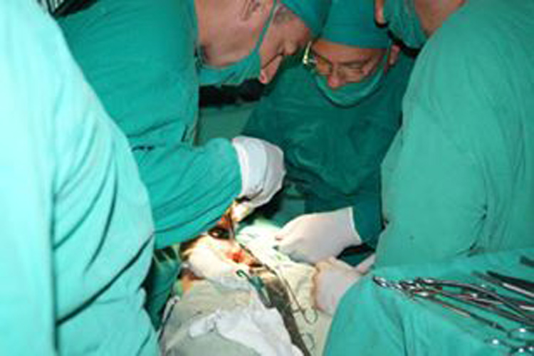 trasplante hepático 2