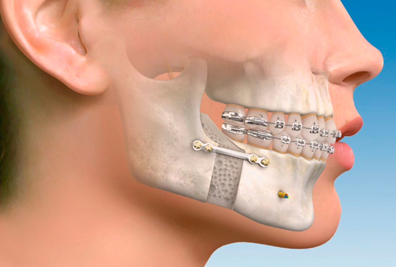 cirugia maxilofacial 1