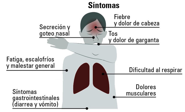 covid19 sintomas