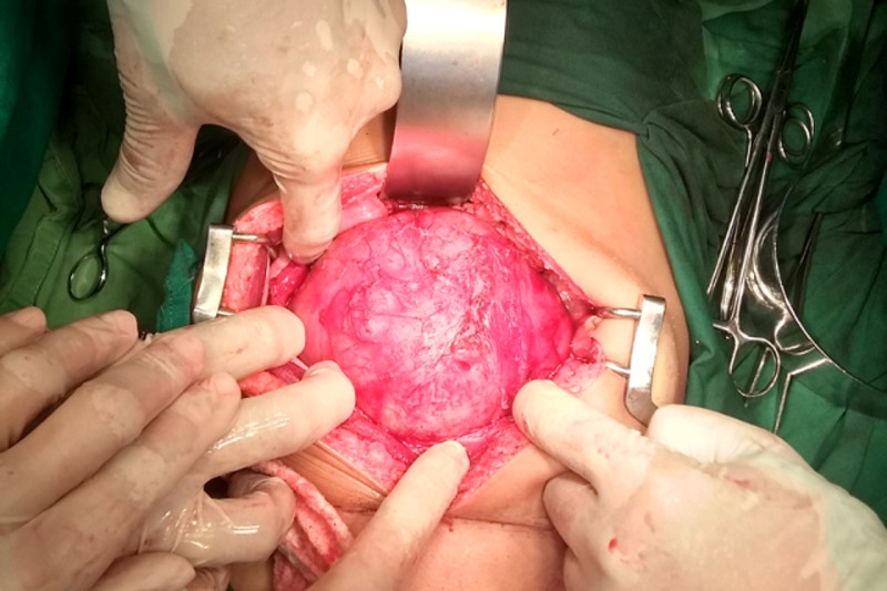 Desarrollan en Holguín protocolo para el diagnóstico precoz de enfermedades malignas en menores de edad. Fotos: Cortesía de la doctora Yurieenk pediatria protocolo 1