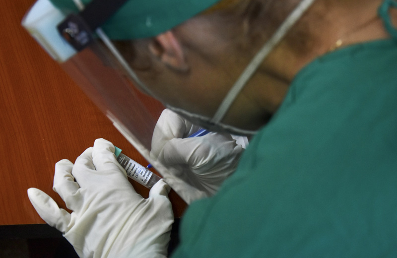 La muestras obtenidas son debidamente conservadas y etiquetadas para su posterior análisis Covid 19 prueba sarcov 2 04