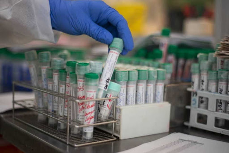 coronavirus positivos