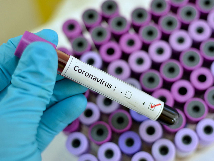 coronavirus f oms