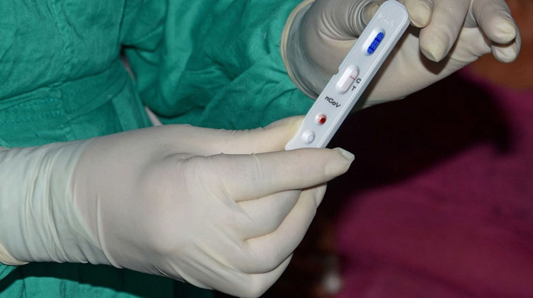 coronavirus test 2
