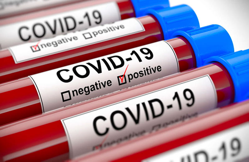 COVID 19 positive kit 11 YA
