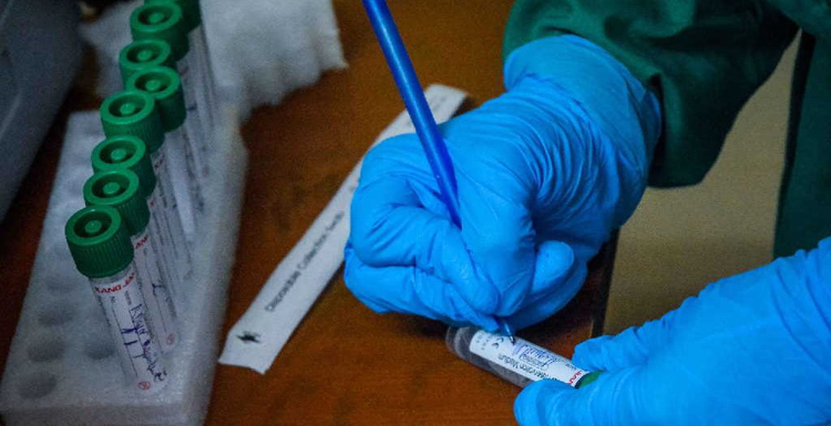 Covid 19 holguineros