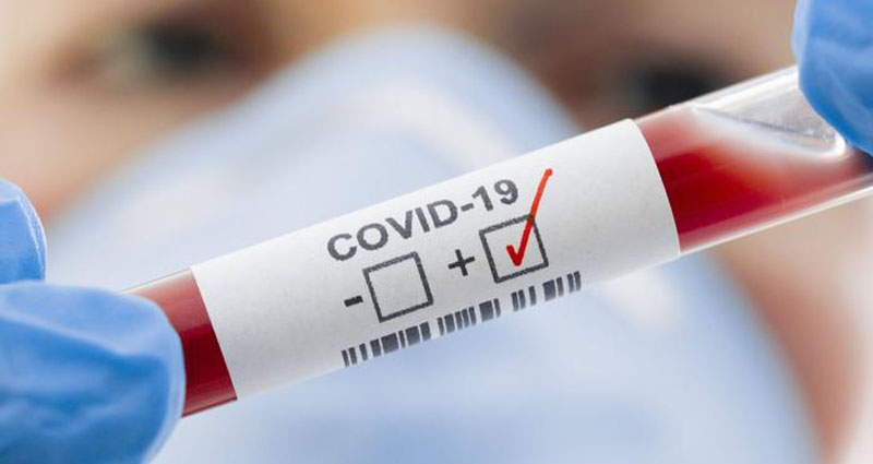 COVID 19 1