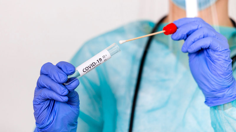 Prueba PCR COVID
