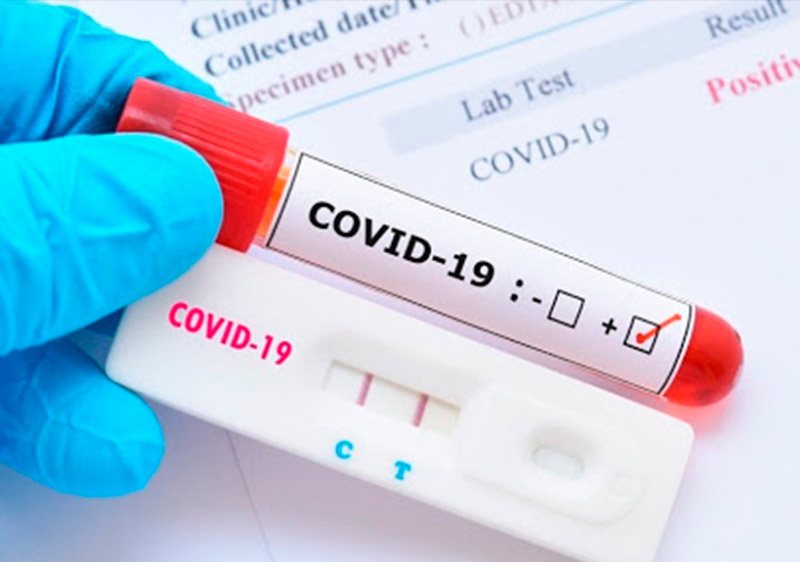 COVID-19