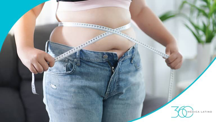 obesidad2