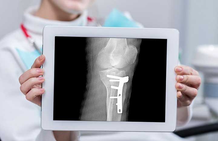 radiografia
