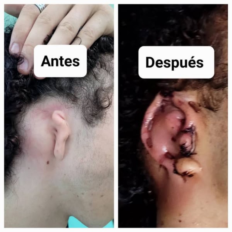 cirugia pediatrico 02