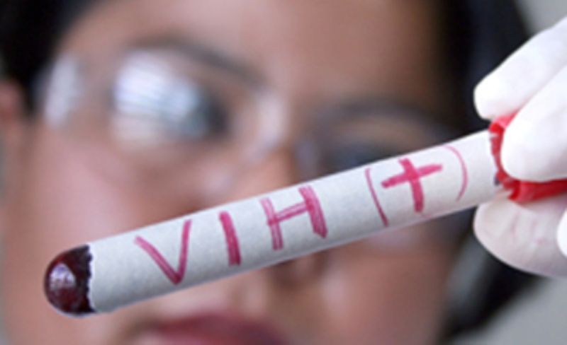 VIH salud1